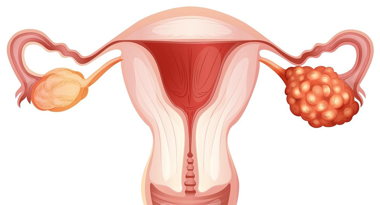 Afbeelding van de baarmoeder en eierstokken